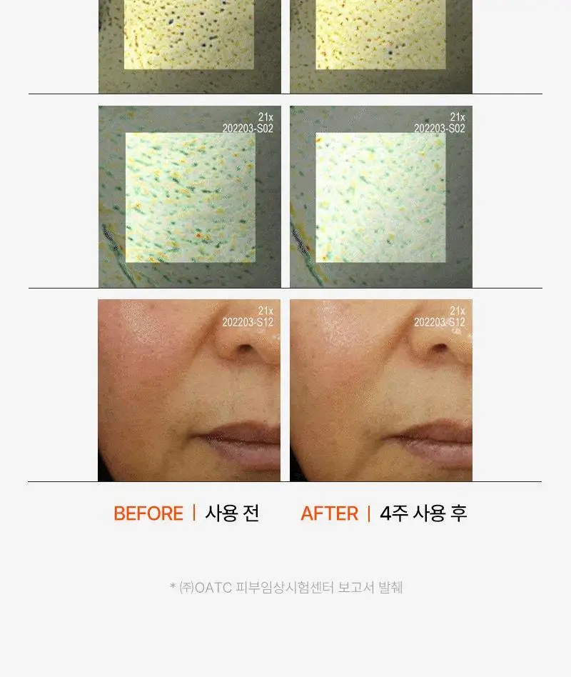 [4중 모공 개선/병풀추출물 7,793ppm] 피캄 포시카 앰플 30ml 상세페이지 13